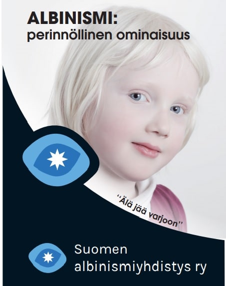 Suomen Albinismiyhdistys